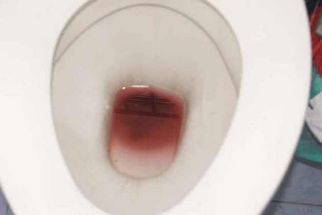 উত্তেজিত হলে পুরুষদের মধ্যে দেখা